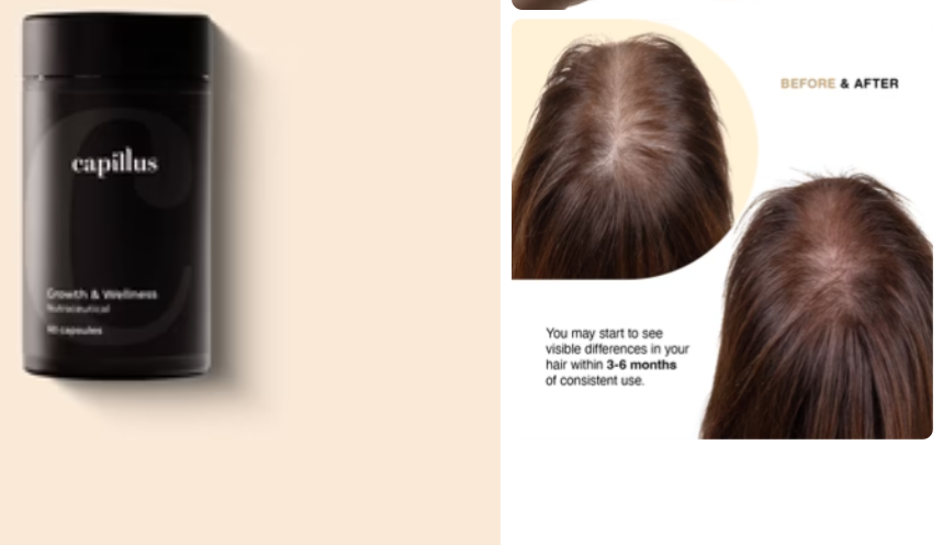 Capillus® Hair Supplement (for Men and Women)